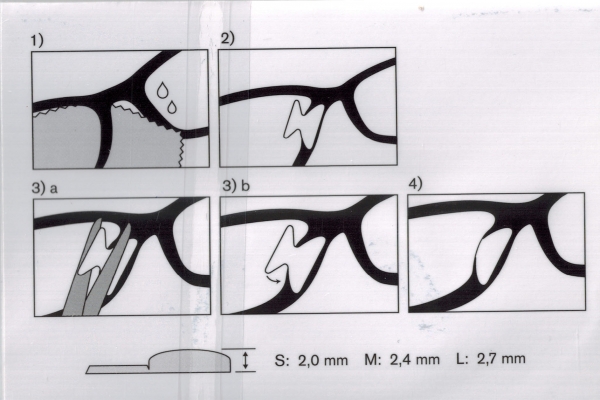 Nasenpolster Nasenpad XL Silikon selbstklebend